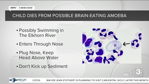 Child in Douglas County dies from a suspected 'brain-eating' amoeba infection