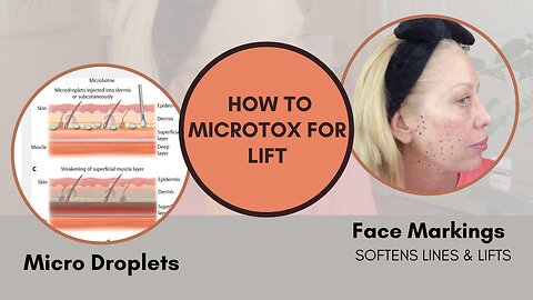 Microtox my Face - Full Video