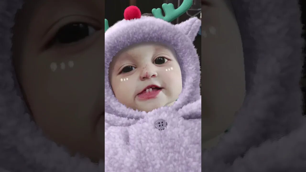 Achi Nani Piyari Nani ☺️☺️🤪#viral #foryou #youtubeshorts #subcribeme #explore #lovebabies #1million