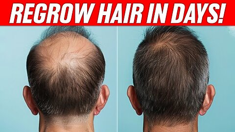 Stop Losing Hair! 🛑 5 Shocking Secrets to Boost Growth 🌱✨💇‍♂️#HairGrowth #HealthyHair #StopHairLoss