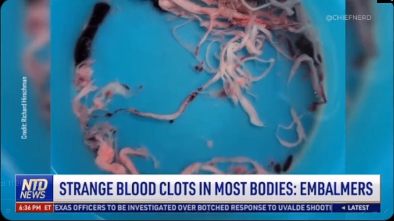 ALERT! Growing in the Bodies of the V@xxed!?!
