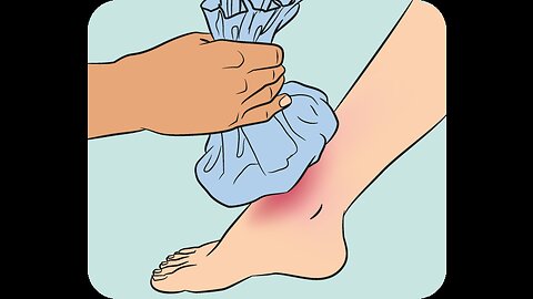 Understanding Ankle Pain and Treatment - Strain, Tendonitis, and Fracture