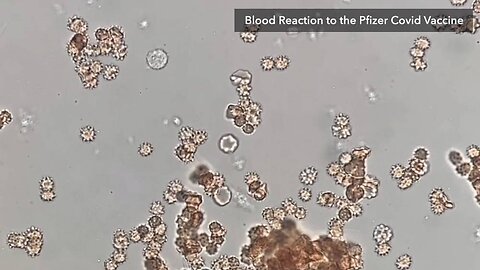 Watch COVID Shot Juice Attack Human Blood In Real Time