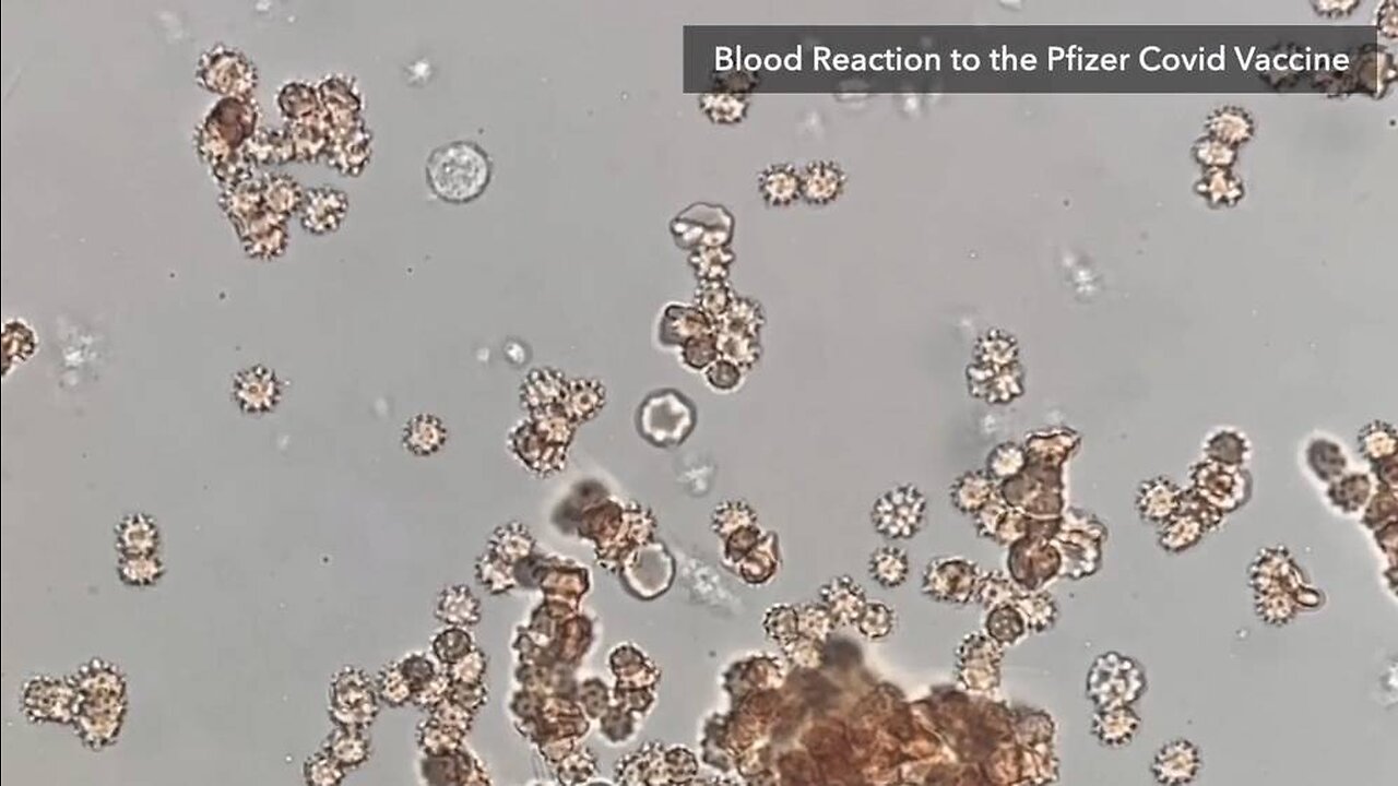 Watch COVID Shot Juice Attack Human Blood In Real Time