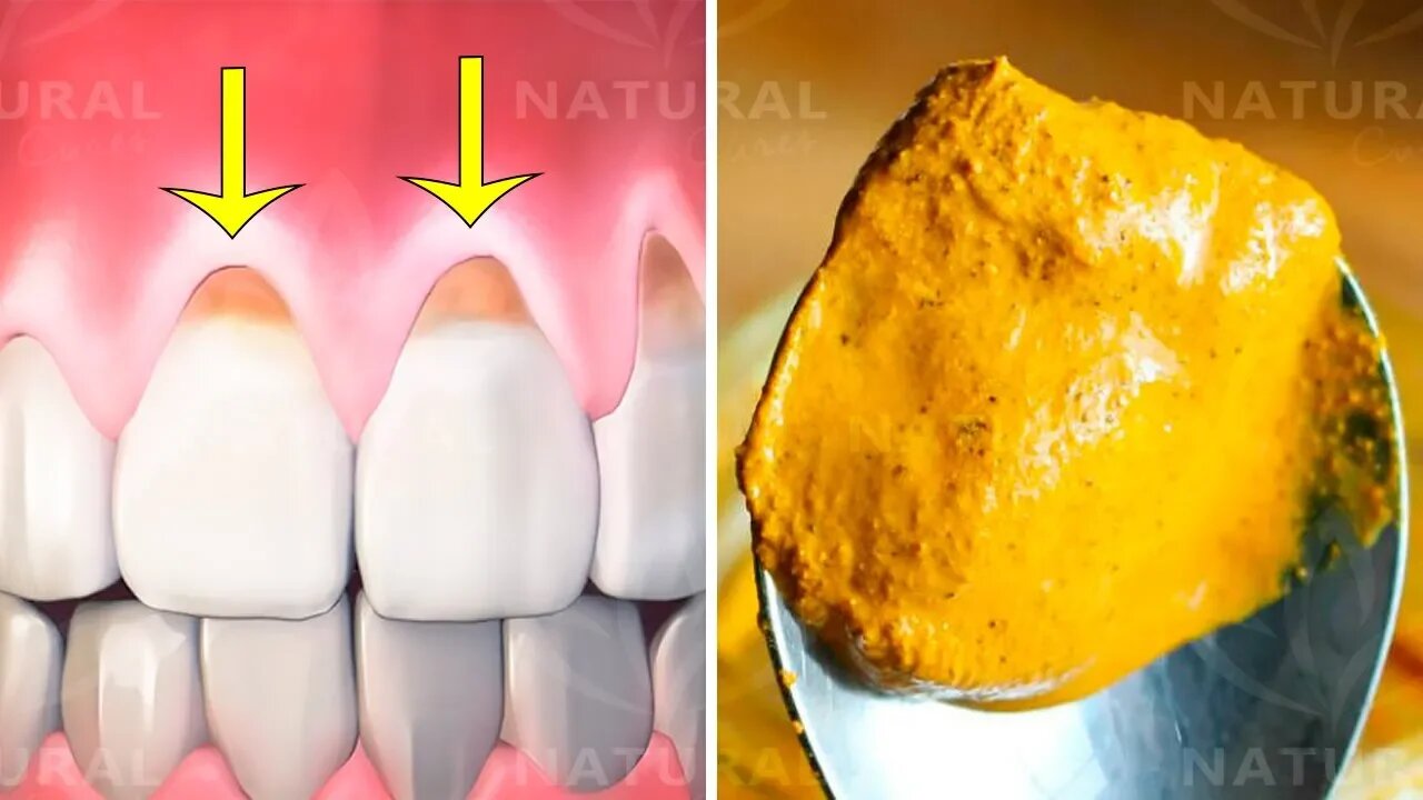 Why Turmeric is Fantastic for Oral Health and Hygiene