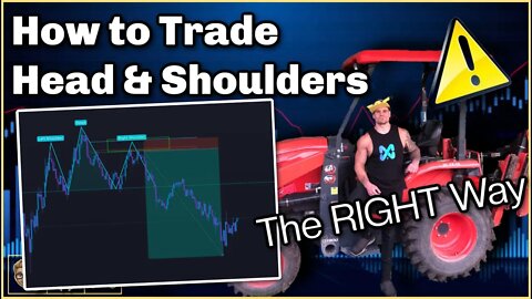 How to Trade Head & Shoulders Pattern (The BEST Way To Trade Head & Shoulders)