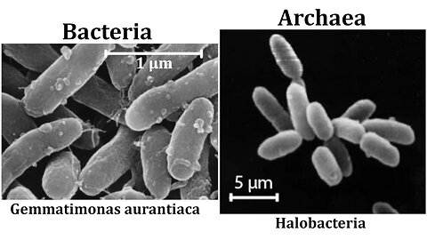 Biological Diversity: Bacteria, Archaea, and Eutrophication