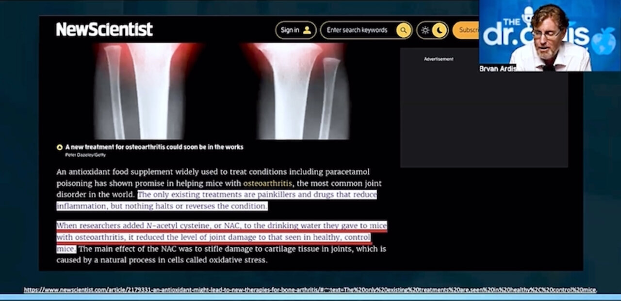 Dr. Bryan Artis on 4 nutrients that help alleviate arthritis. Nicotine patches - near the end