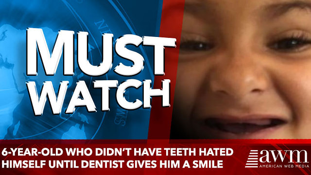 6-Year-Old Who Didn’t Have Teeth Hated Himself Until Dentist Gives An Unreal Transformation For Free