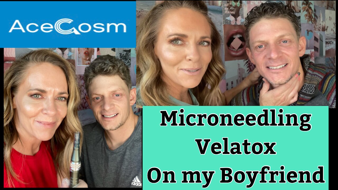 Microneedling Velatox on My Boyfriend | Stimulate Collagen & Elastin | Anti-Aging