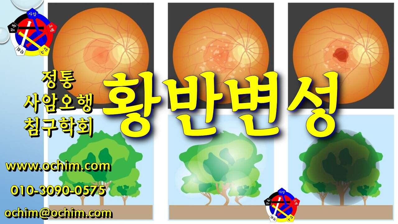 황반변성 치료 방법 및 치료 사례 - 비과학적 양의학 212 - 사암침, 사암침법, 정통사암침