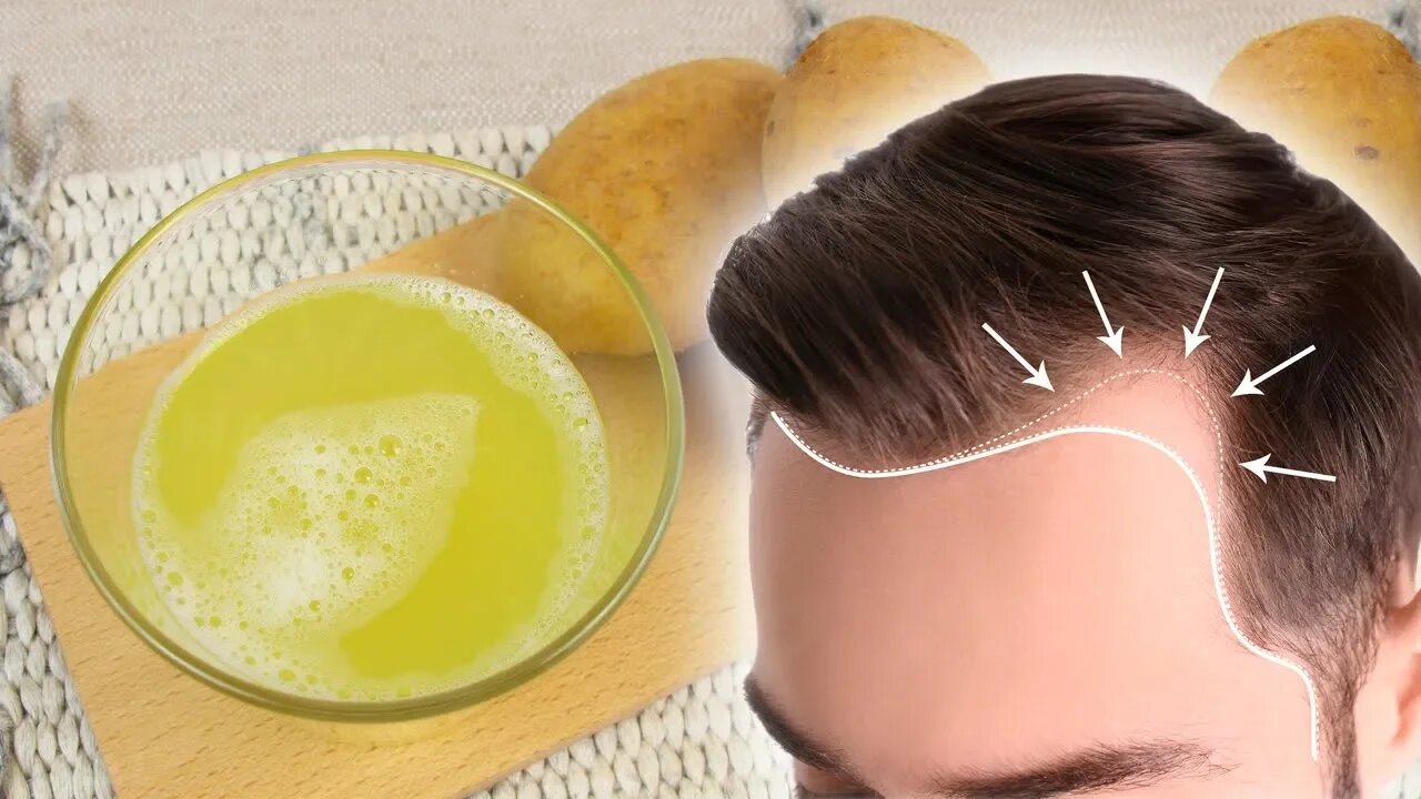 How to Stop Hair Loss Naturally