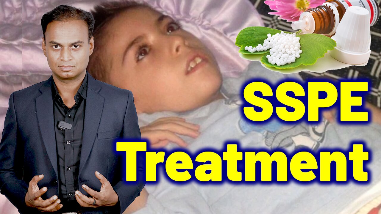 Treatment For SSPE, Subacute Sclerosing Panencephalitis, Dowson Disease | Homeopathy Treatment Cure