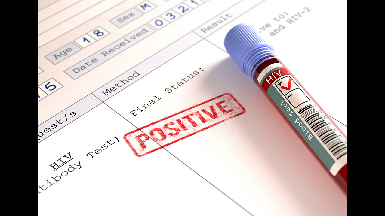 HIV- Positively False