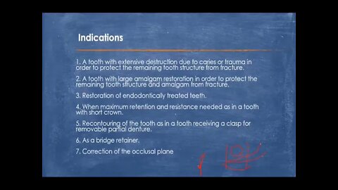 Operative L13 (Fixed Prosthodontics: Full Coverage Restoration "Crown")