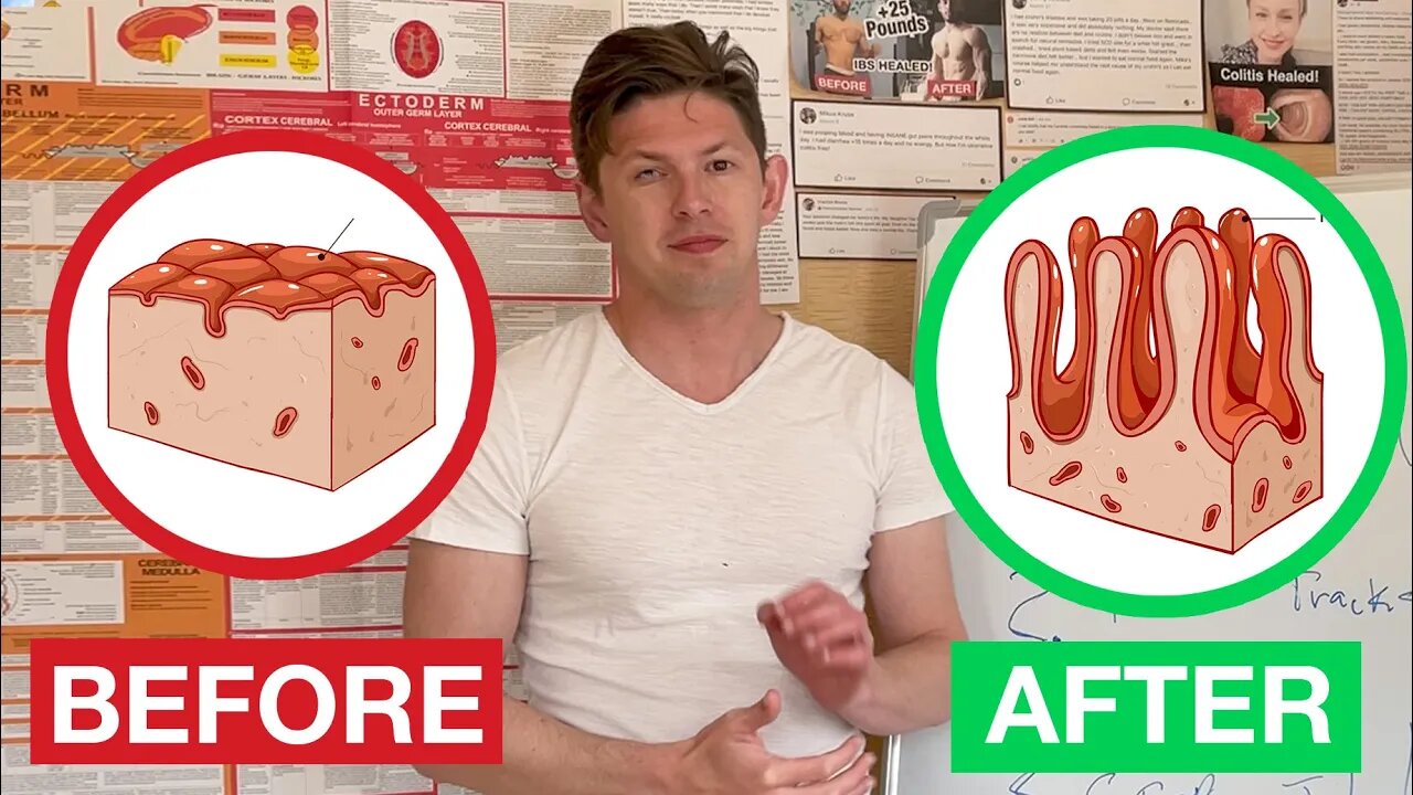 My Crohn's Disease Story || How I Healed My Crohn's Disease