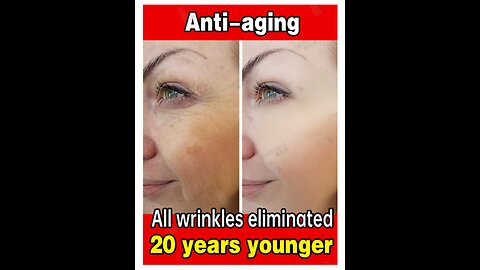 How can I reduce wrinkles on my face fast