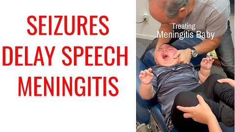 2 year old w/ Meningitis & Seizure gets treated by Chiropractor