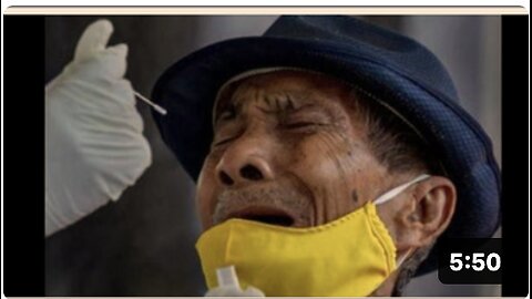 MORE PROOF THE CONVID NASAL SWABS ARE CONTAMINATED WITH MORGELLONS FIBERS!