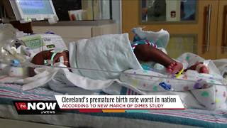 Cleveland ranks worst in the nation for premature birth rates