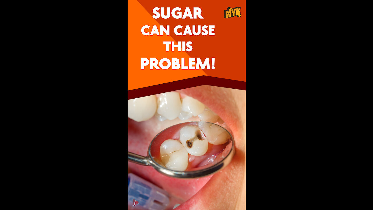 What Causes Cavity *