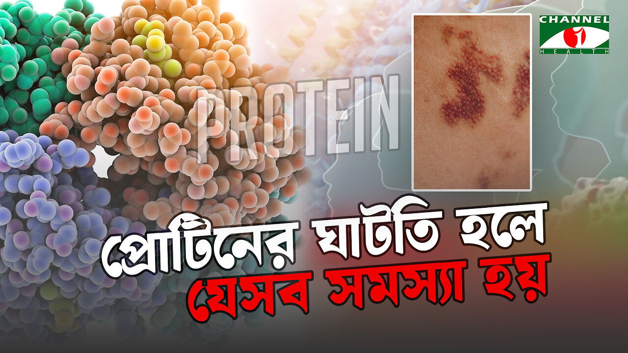 শরীরে প্রোটিনের ঘাটতি হলে যেসব সমস্যা হয় | Symptoms Of Protein Deficiency | Bangla Health Tips