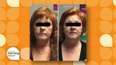 Sage Wellness Offers Permanent Body Contouring Procedures