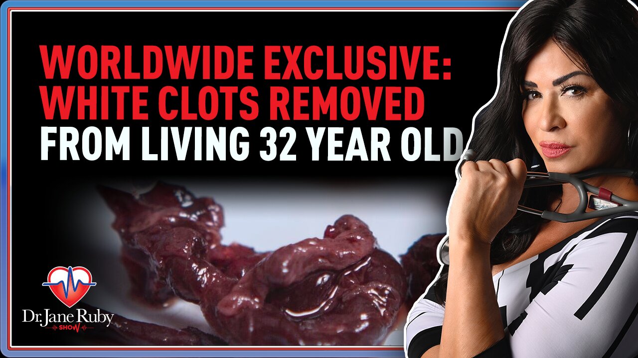 Dr. Jane Ruby: Worldwide Exclusive: White Clots Removed From Living 32 Year Old