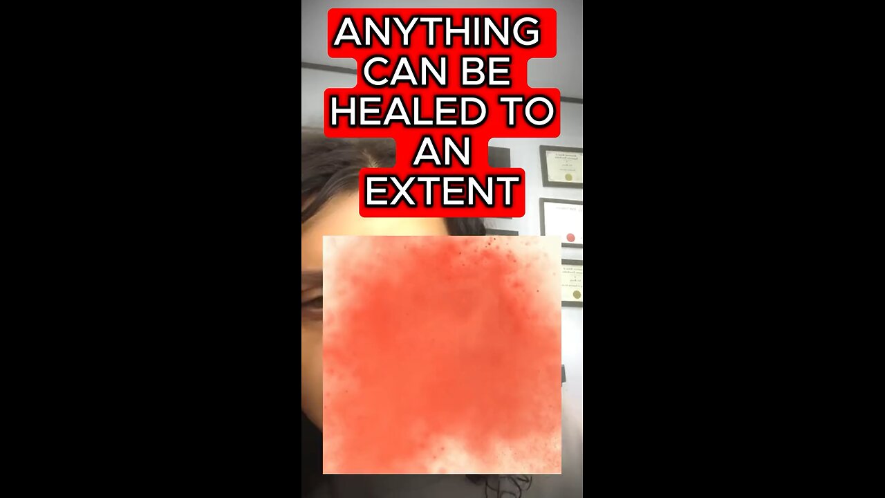 Heal it all