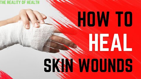 How to Heal Skin Wounds