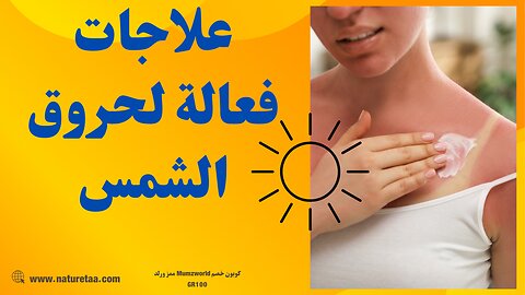 كيفية علاج حروق الشمس بشكل طبيعي #العودة_للطبيعة