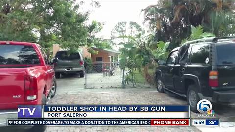 Young child shot by BB gun