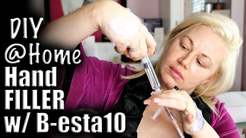 DIY HAND FILLER USING B-ESTA10 FROM ACECOSM.COM | CODE JESSICA10 SAVES YOU $