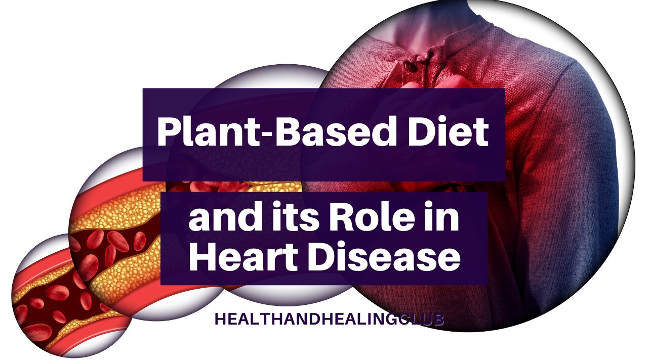 Plant-Based Diet and its Role in Heart Disease - Dr. Joel Kahn, M.D.