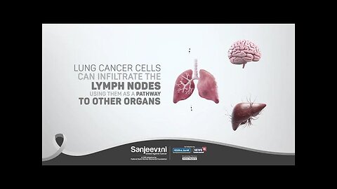 Lung Cancer Factoid | Sanjeevani