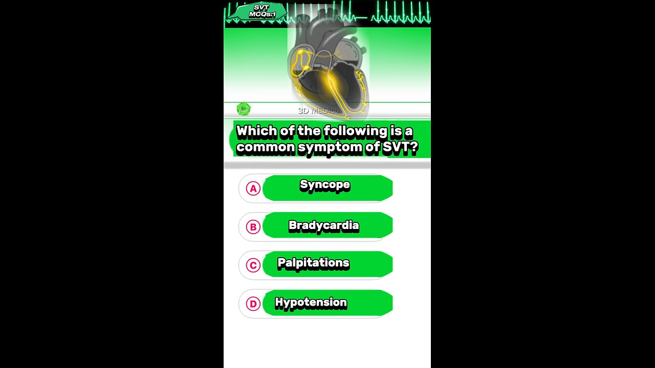 SVT question answered mcqs #supraventriculartachycardia #