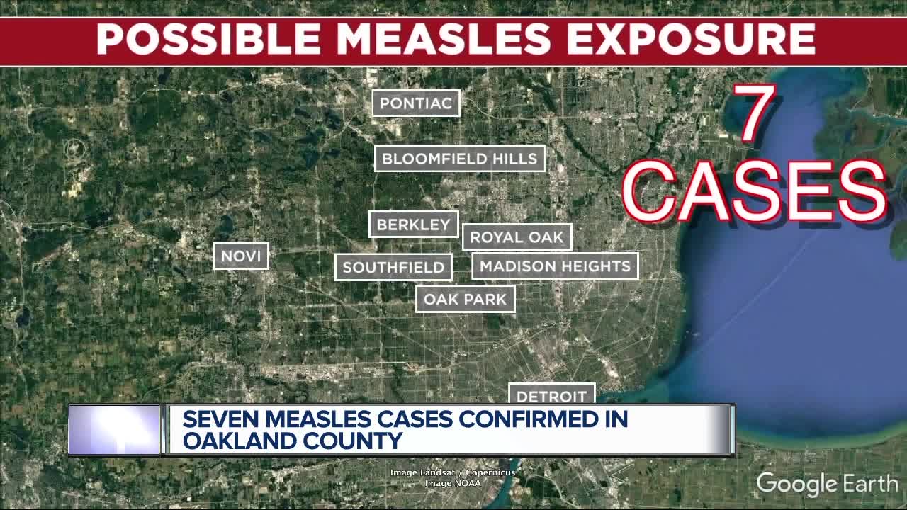 4 additional cases of measles confirmed in Oakland County