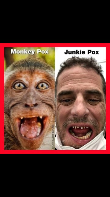 🙉"THIS MONKEYPOX SH*T AIN'T NO JOKE"🙊"MAN GOES BANANAS AFTER CONTRACTING MONKEYPOX"🙈