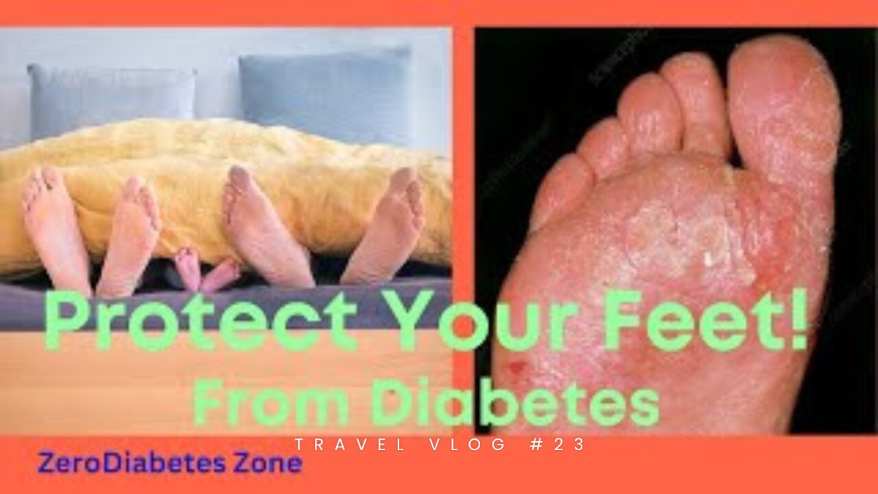 Protect Your Feet! from Diabetes | ZeroDiabetes Zone