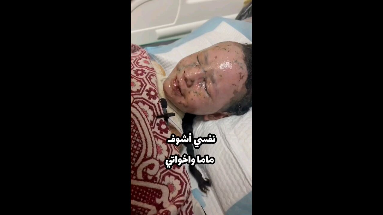 الطفلة حنان عقل أصيبت في قصف للاحتلال على المخيم وعائلتها تناشد من أجل فتح المعابر وسفرها للعلاج