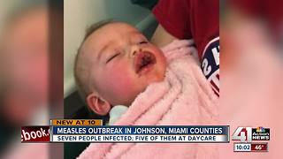 7 cases of measles identified in Kansas