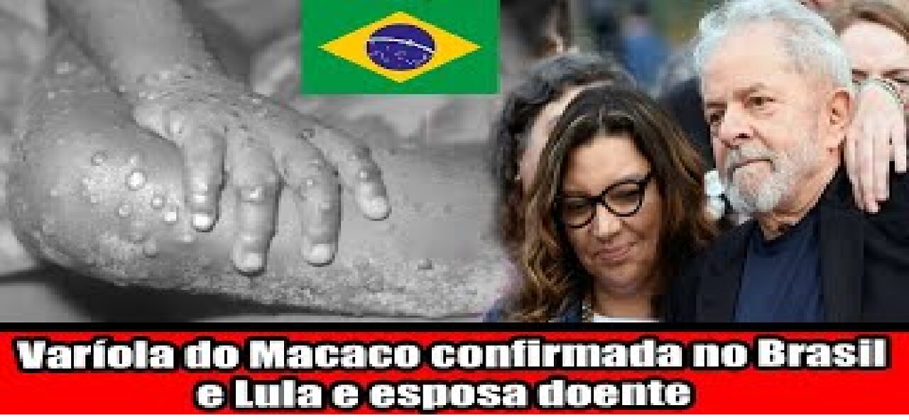 Varíola do Macaco confirmada no Brasil e Lula e esposa doente