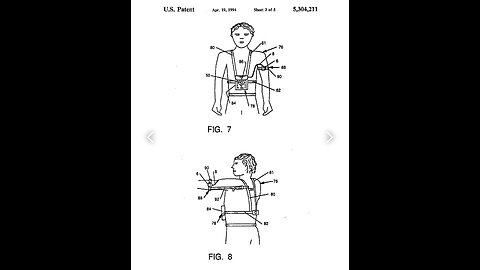 ELECTRIC SHOCK FOR BEHAVIOR MODIFICATION