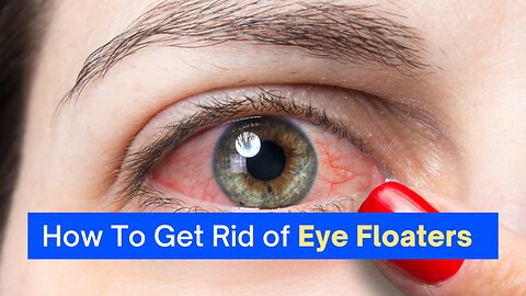 Eye Floaters No More! Find out how to get rid of your annoying Eye Floaters!