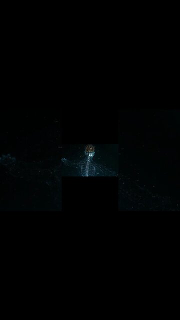 Relief Pain Through Music - 174Hz Solfeggio Binaural Beats - Heal Body and Mind