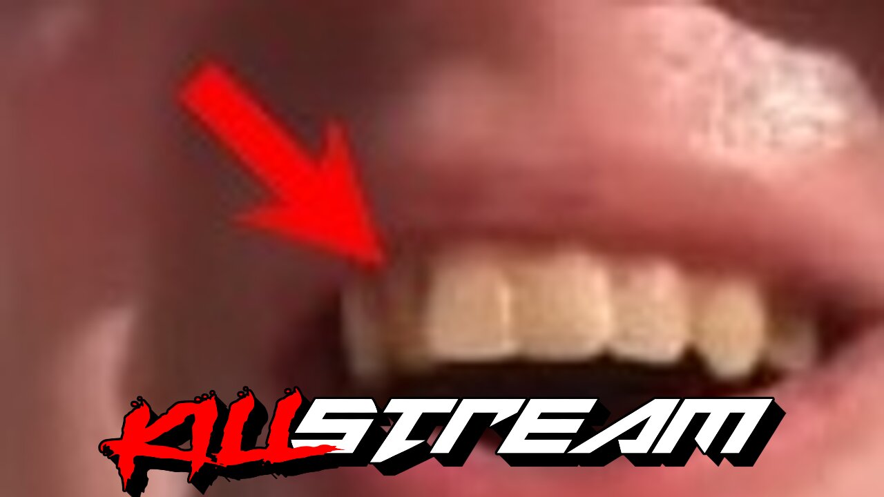 KILLSTREAM: PPP's ROTTEN TEETH, TRUMP BAILOUT, + CEASEFIRE PASSES at UN