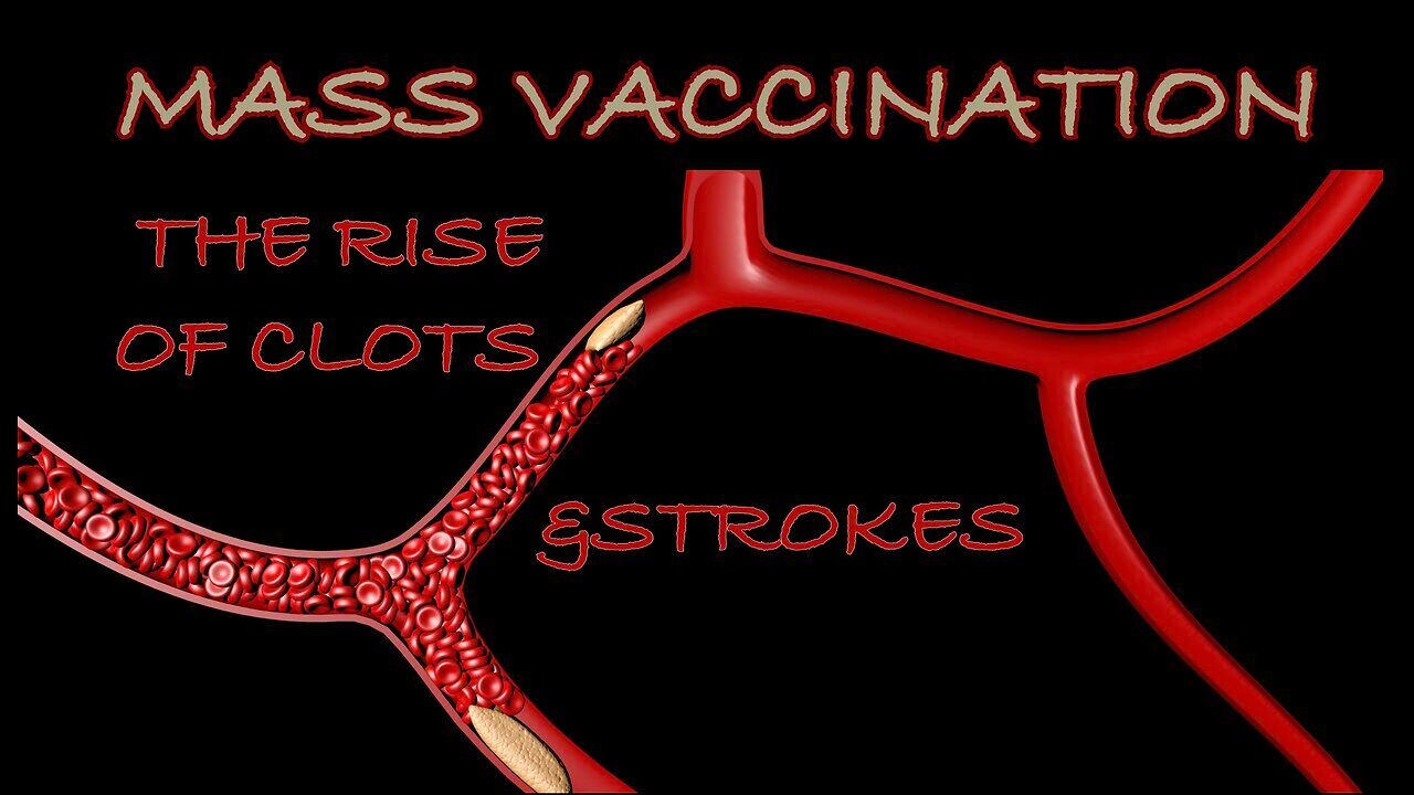 Mass Vaccination: the rise of CLOTS and STROKES