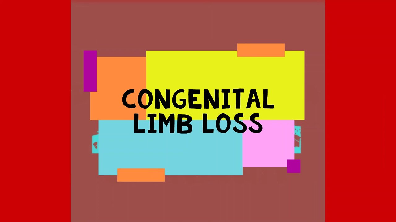 Congenital Limb Loss