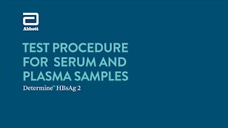 SOUTH AFRICA - Cape Town - Rapid diagnostic test for the detection of hepatitis B(Video) (SRQ)