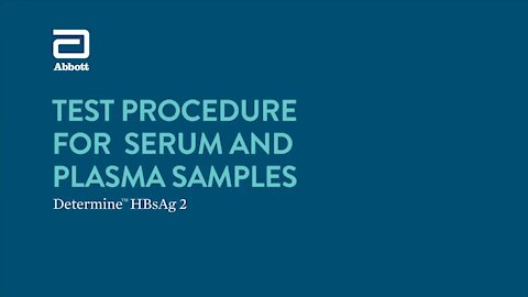 SOUTH AFRICA - Cape Town - Rapid diagnostic test for the detection of hepatitis B(Video) (SRQ)